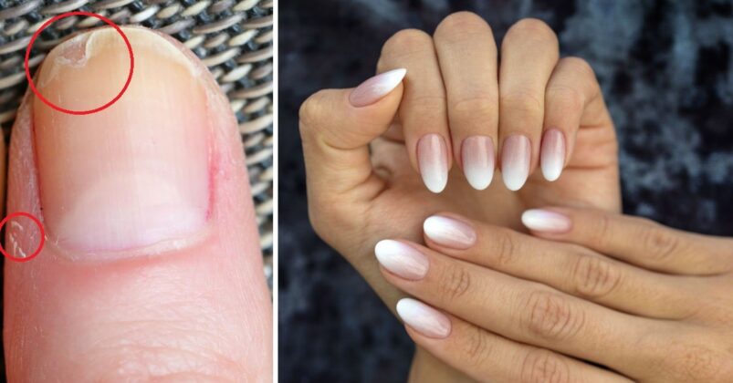 3 ways to strengthen brittle nails with garlic so they grow fast