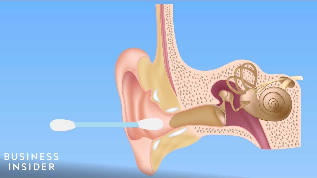 Forget Q-tips! Here’s how you should be cleaning your ears!