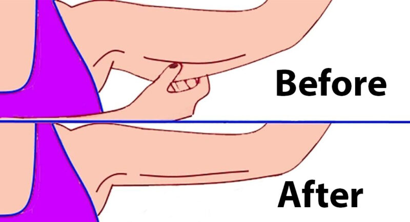 6 Exercises to Get Rid of Flabby Arms